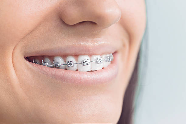 Why Choose Us for Your Dental Needs in Greenwood, SC